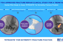 RevBio Receives FDA Approval for First Clinical Trial of TETRANITE Bone Glue to Treat Extremity Fractures