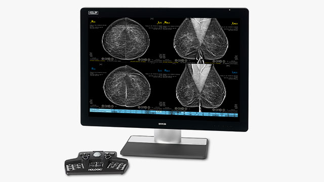 Hologic’s 3DQuorum® imaging technology